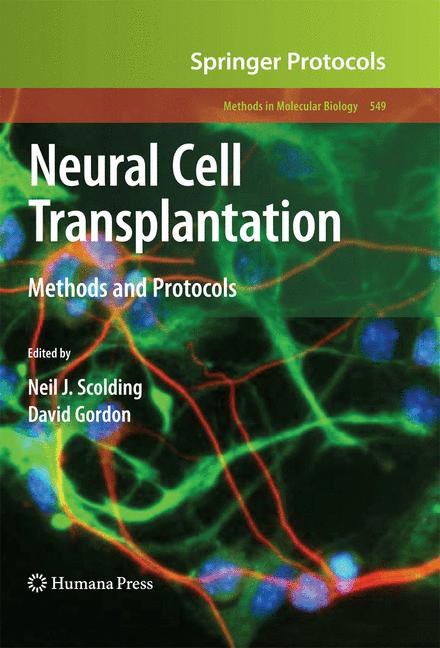 Neural Cell Transpl… - image