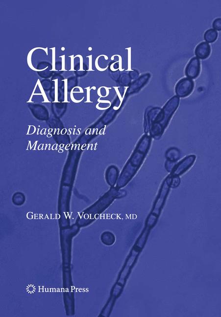 Clinical Allergy - image
