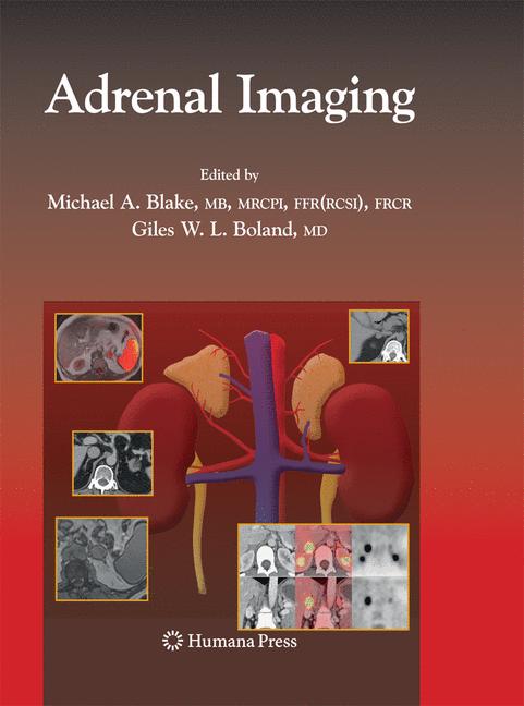 Adrenal Imaging - image