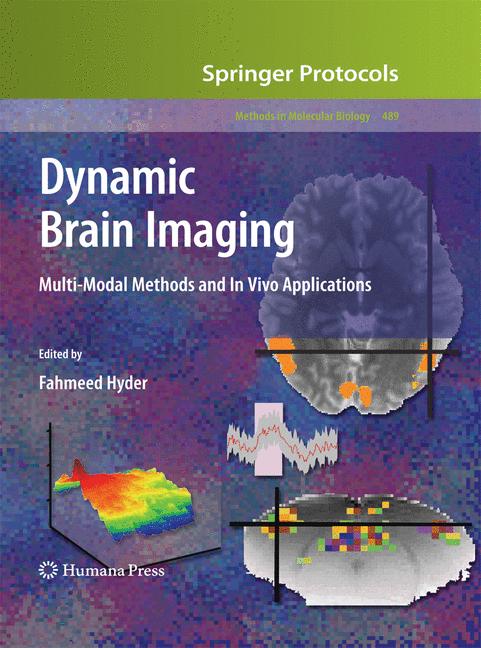 Dynamic Brain Imagi…
