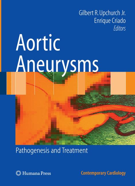Humana Aortic Aneurysms