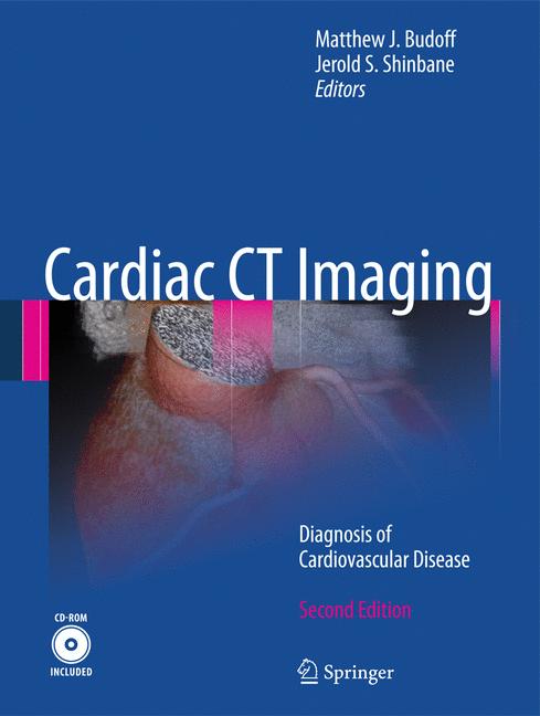 Cardiac Ct Imaging