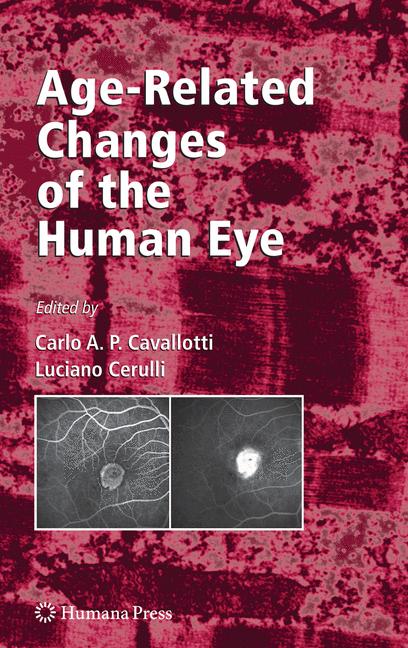 Age-Related Changes of the Human Eye-image-978-1-934115-55-8
