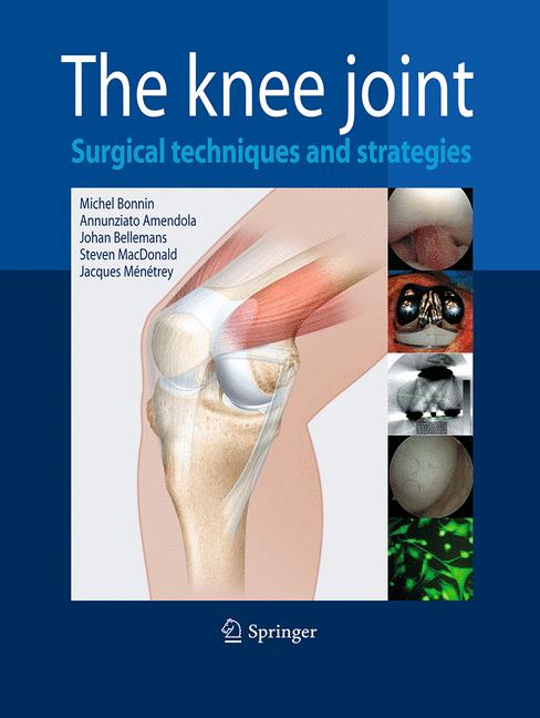 The Knee Joint - image