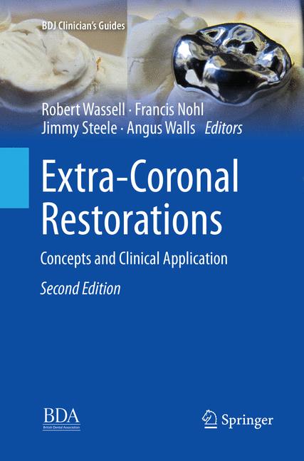 Extra-Coronal Resto…
