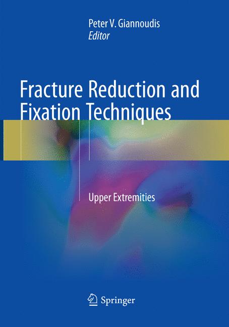 Fracture Reduction …