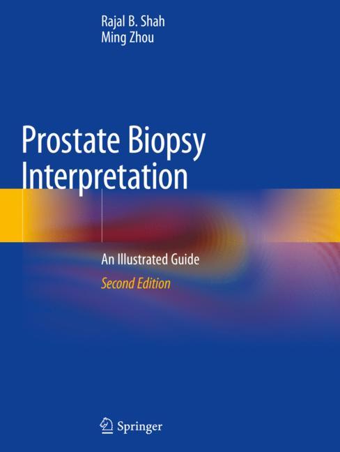Prostate Biopsy Int…