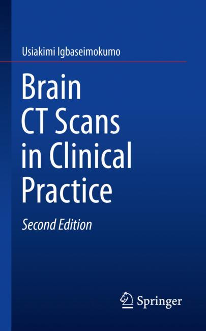 Brain Ct Scans In C… - image