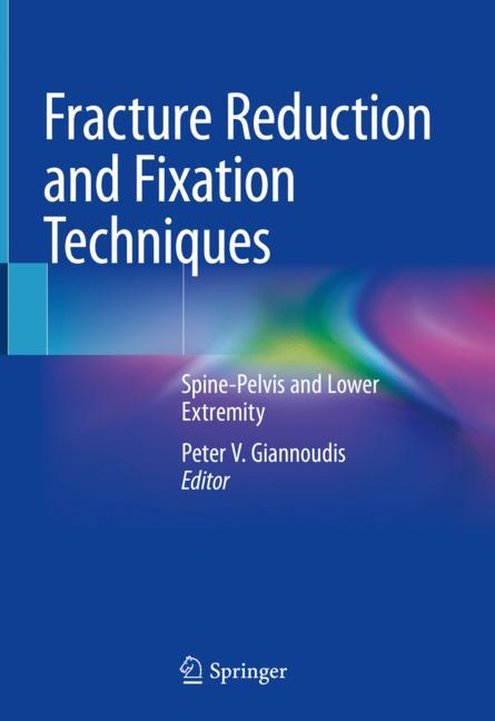 Fracture Reduction …