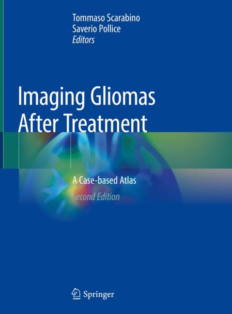 Imaging Gliomas Aft…