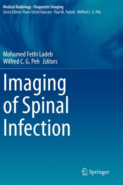 Imaging Of Spinal I…