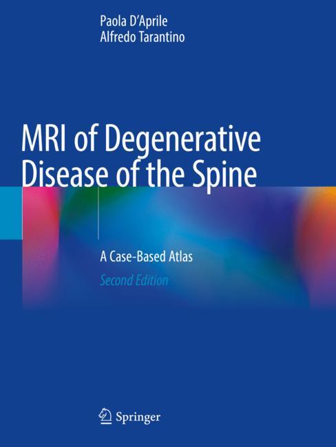 Mri Of Degenerative…