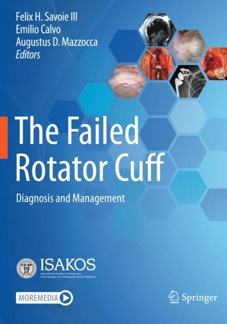 The Failed Rotator …