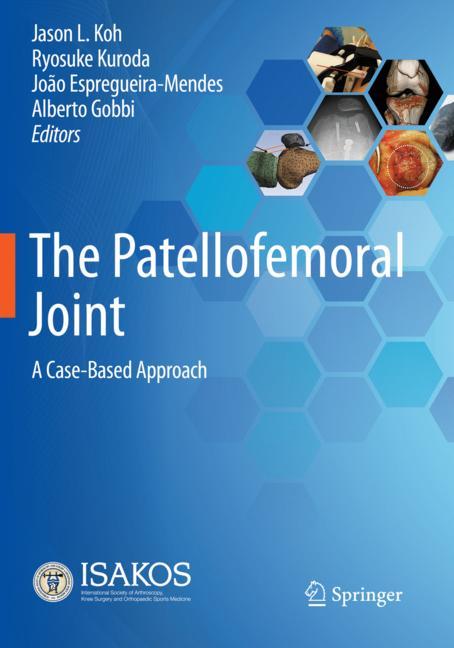 The Patellofemoral …