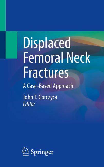 Displaced Femoral N…