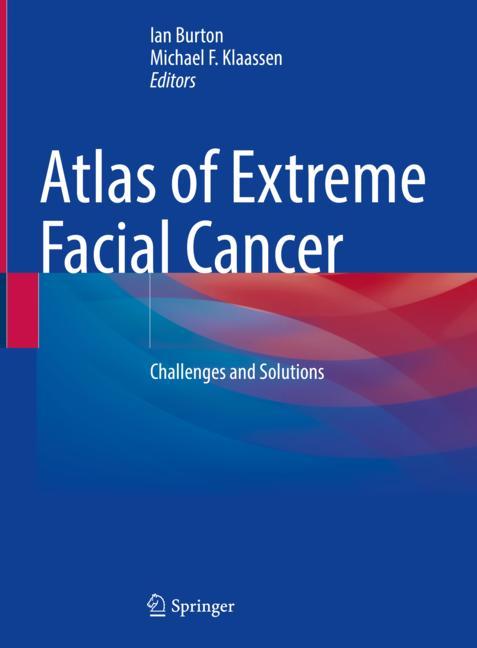 Atlas Of Extreme Fa…