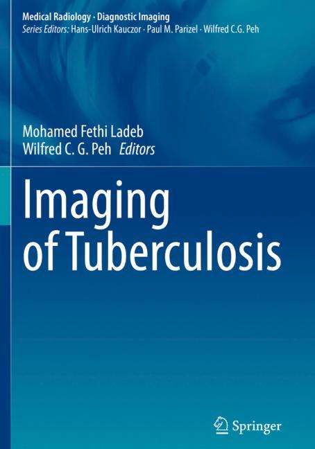 Imaging Of Tubercul… - image