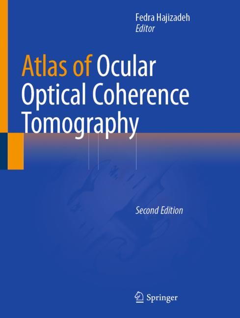 Atlas Of Ocular Opt…