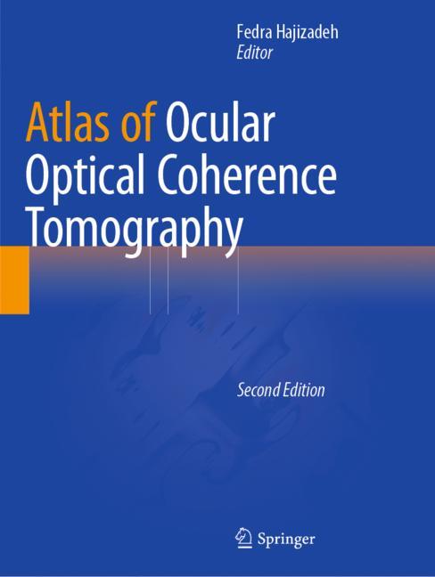 Atlas Of Ocular Opt…