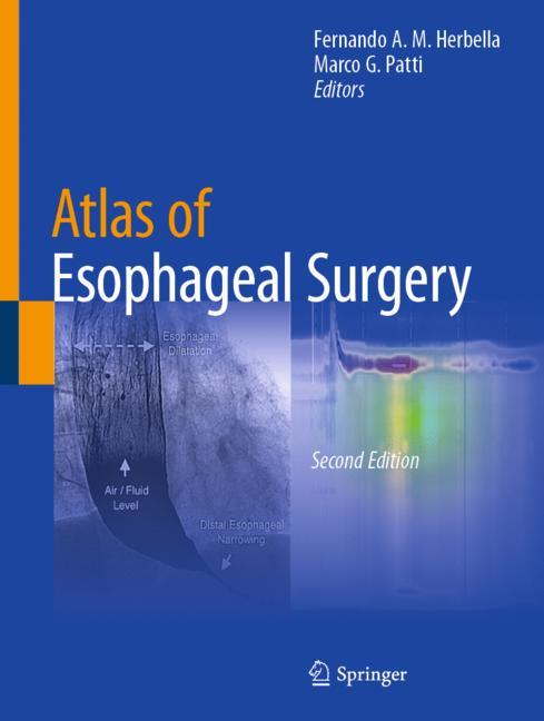Atlas of Esophageal Surgery-image-978-3-031-12790-8