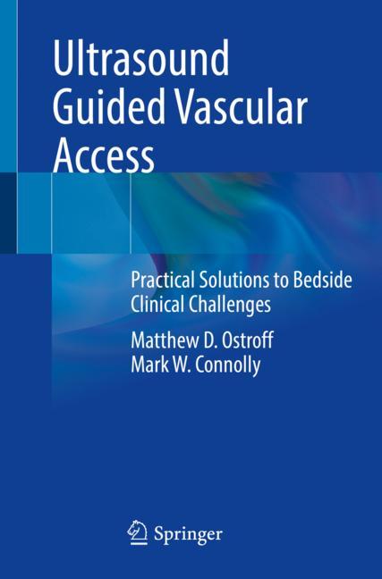 Ultrasound Guided V…