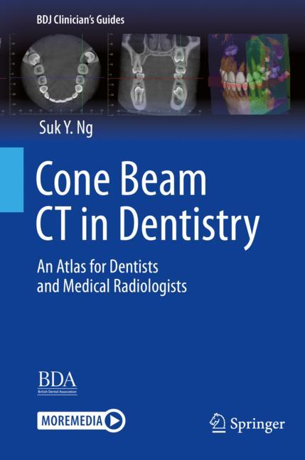 Cone Beam Ct In Den…