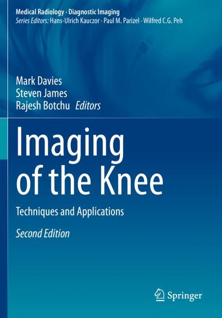 Imaging Of The Knee