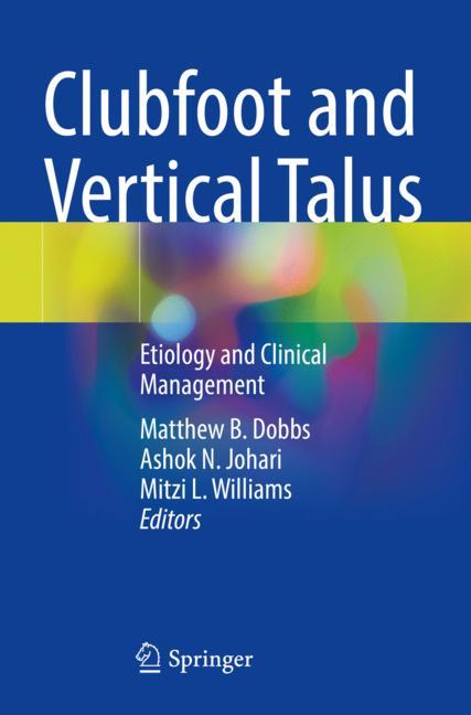 Clubfoot And Vertic…