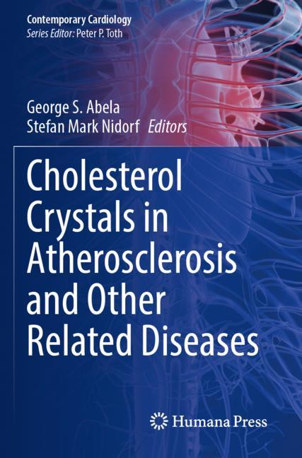 Cholesterol Crystal…