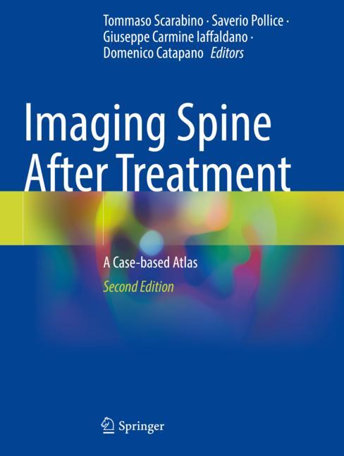 Imaging Spine After…