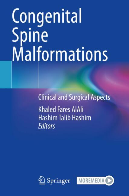 Congenital Spine Ma…
