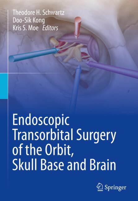 Endoscopic Transorb…