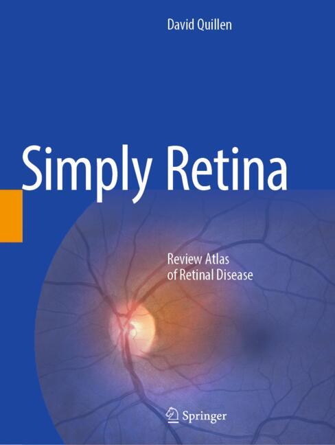 Simply Retina