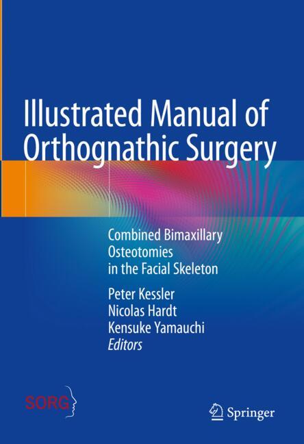 Springer Illustrated Manual Of Orthognathic Surgery