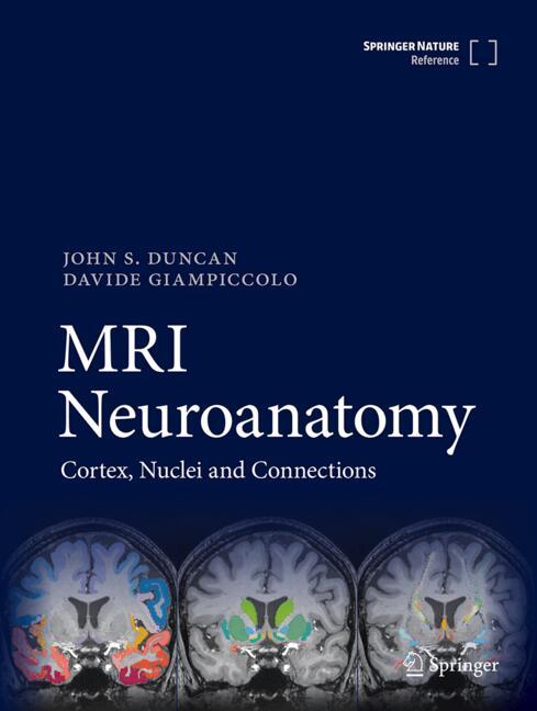 MRI Neuroanatomy