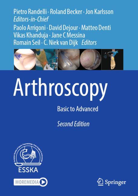 Arthroscopy