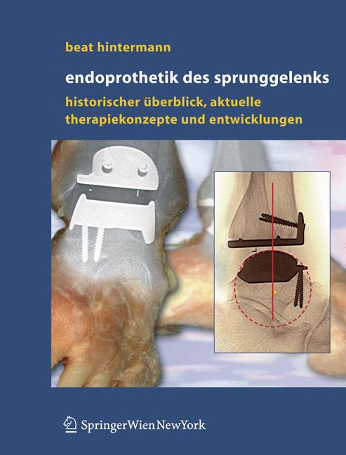 Endoprothetik Des S…