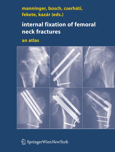 Internal Fixation O…