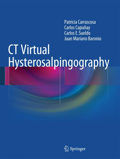 Ct Virtual Hysteros…
