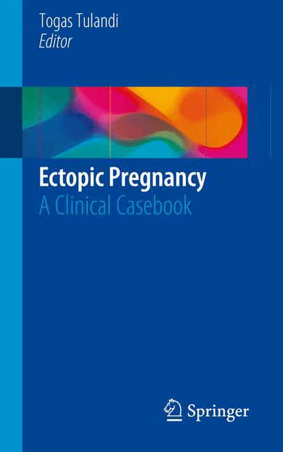 Ectopic Pregnancy - image