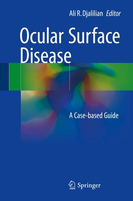 Ocular Surface Dise…