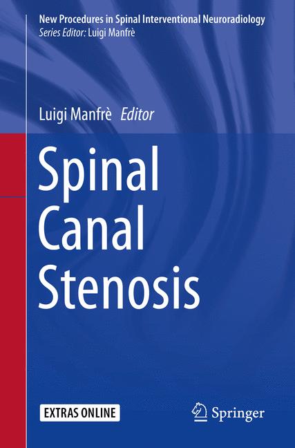 Spinal Canal Stenos…