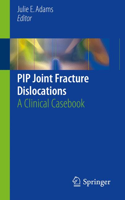 Pip Joint Fracture …
