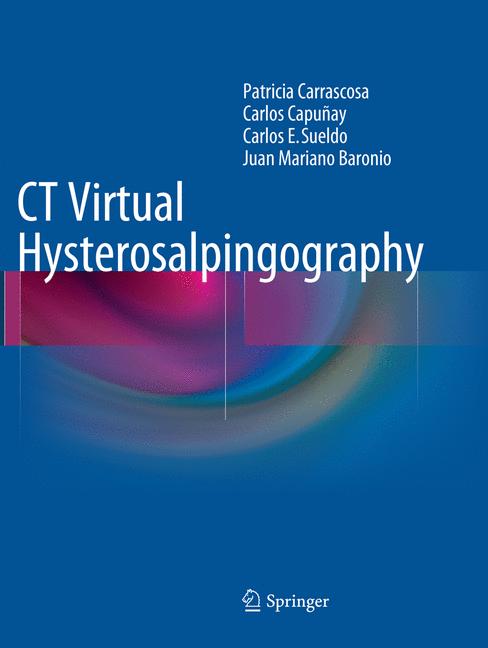 Ct Virtual Hysteros…