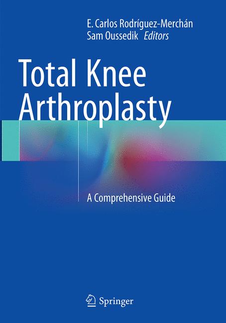 Total Knee Arthropl… - image