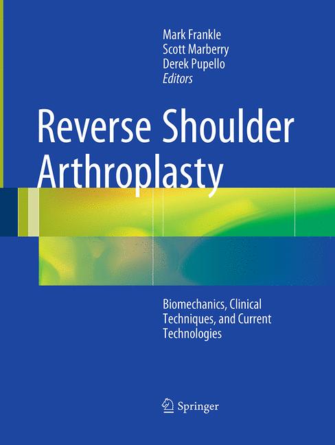 Reverse Shoulder Ar…