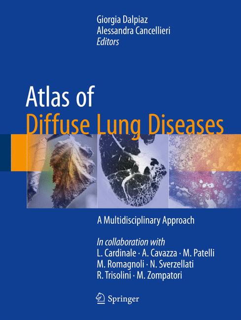 Atlas Of Diffuse Lu…