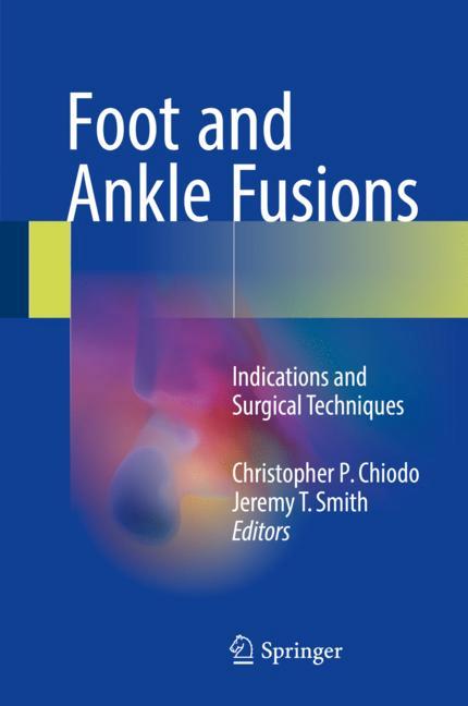 Foot And Ankle Fusi…
