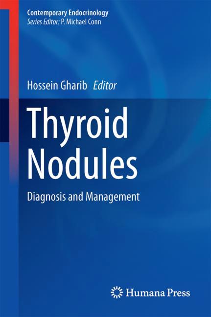 Thyroid Nodules