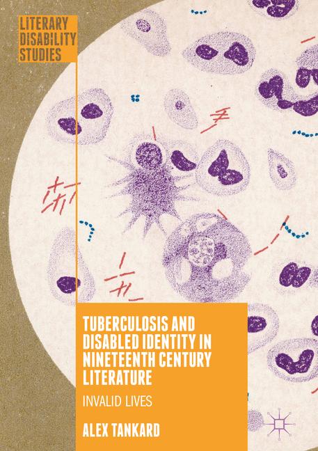 Tuberculosis And Di…